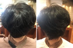 「つむじが分かれるようになった」その原因と改善策‼️