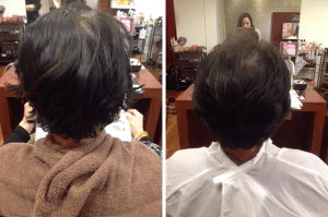 長年の髪の悩みを改善！トップのボリュームがなく、つむじが分かれてしまう、、