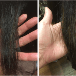 頭皮と髪のアンチエイジングケアで見た目年齢2割増し！初めてヘアーホスピ体験されるお客様！