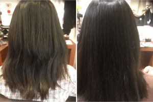 美容業界の「インフォームド・コンセント」