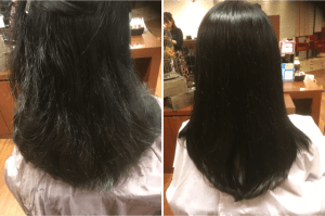 リスクの少ない矯正ストレート！