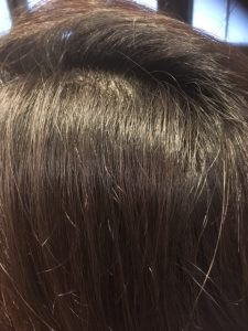 ストレートパーマの失敗　～根折れ～