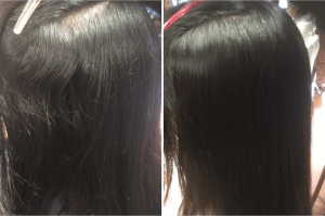 同じ人だからって、同じ薬剤、同じ施術ではない！