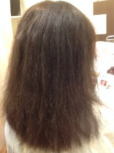 ビビリ毛から10か月後の現在！