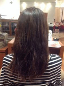 毛髪復元メニューを続けて3年。今が人生で一番楽！