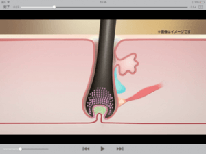 毛髪復元メニュー、ヘアーホスピで髪が増える！？