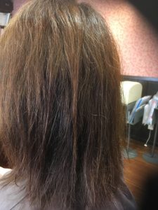 「続ければ必ず髪は改善できる」の証拠！