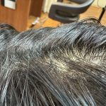 縮毛矯正の根折れでご相談に来た方のその後！